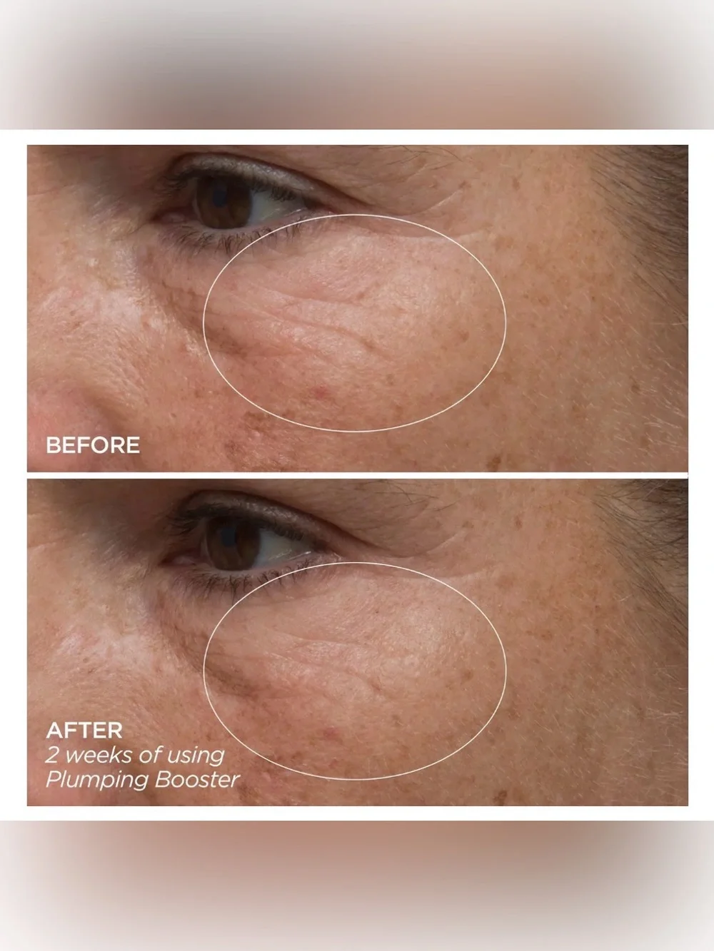 BEAUTYBIO Plumping Booster Hyaluronic Acid Supercharged Complex